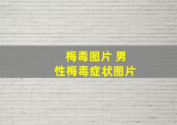 梅毒图片 男性梅毒症状图片